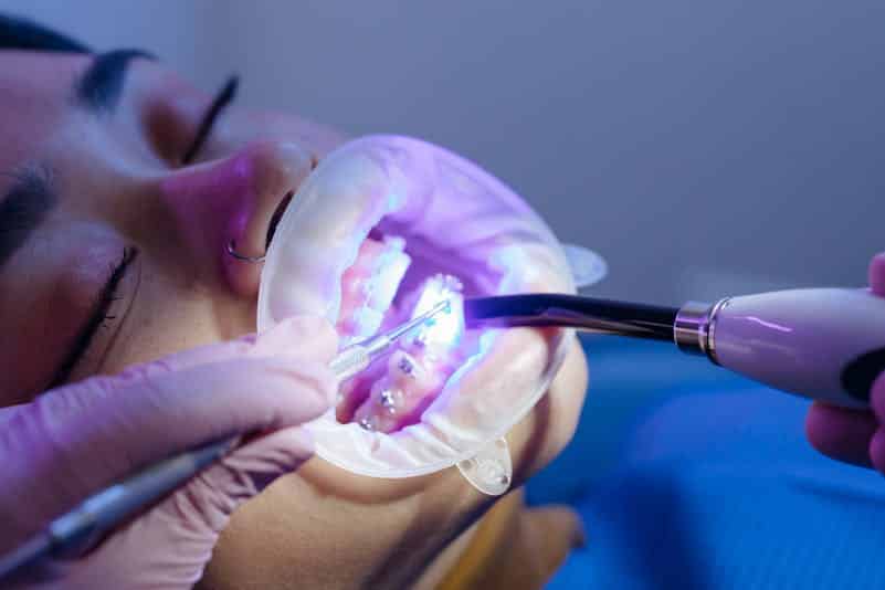 Braces & Orthodontics in Beaumont TX