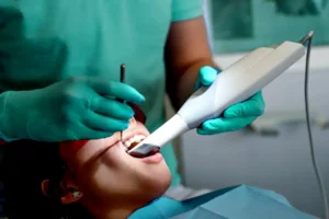 Top Questions About Dental Intraoral Scanners Answered