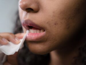 Dentist in Baytown TX: How Dry Mouth Affects Teeth