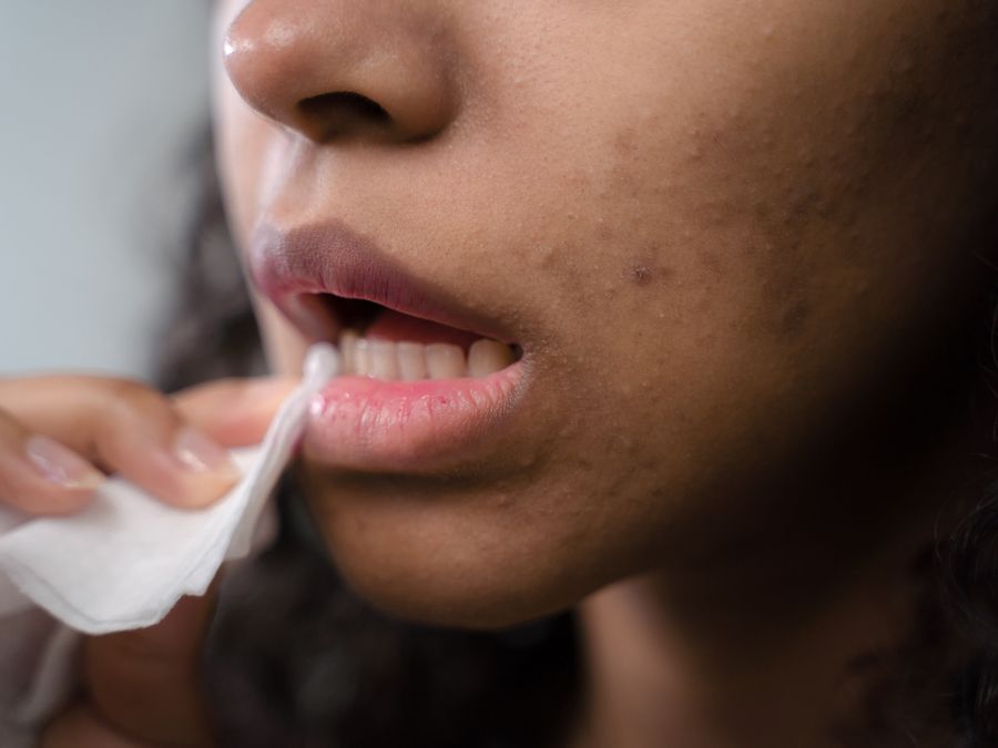 Dentist in Baytown TX: How Dry Mouth Affects Teeth